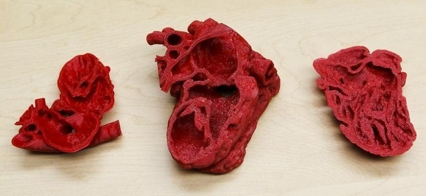 Corazones en 3D que salvan vidas Corazones impresos en 3D