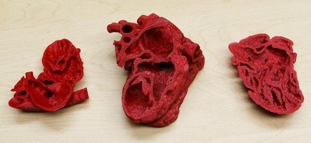 Corazones en 3D que salvan vidas Corazones impresos en 3D